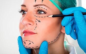 Lifting facial completo