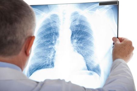 Espirometría